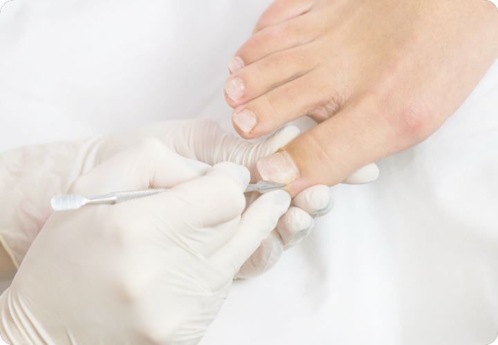 補正器具の装着（施術）