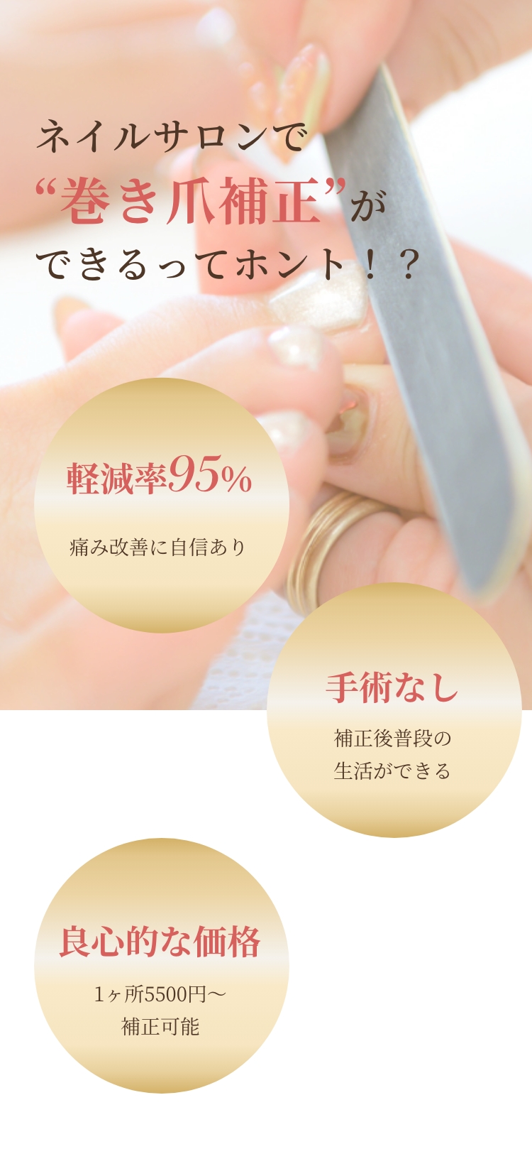 ネイルサロンで“巻き爪補正”ができるってホント！？