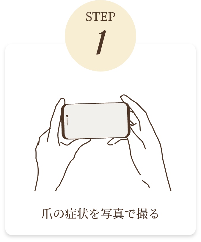 爪の症状を写真で撮る